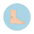 Ankle option in Lody